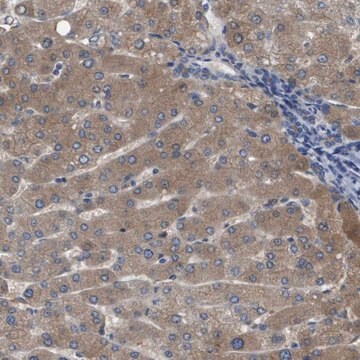 Anti-SERPINA6 antibody produced in rabbit Prestige Antibodies&#174; Powered by Atlas Antibodies, affinity isolated antibody, buffered aqueous glycerol solution