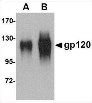 Anti-gp120 antibody produced in goat affinity isolated antibody, buffered aqueous solution