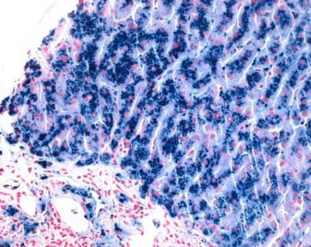 HEMATOGNOST Fe&#8482; staining kit for the detection of free ionic iron (Fe&#179;&#8314;) in cells