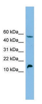 Anti-EPO antibody produced in rabbit affinity isolated antibody