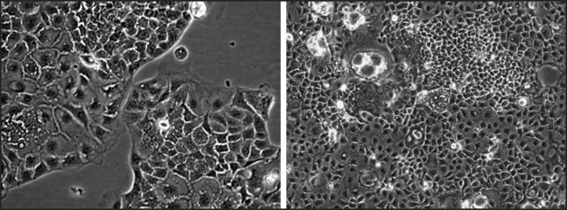 MDR1/MRP2 Double Knockout Caco-2 Cells one vial