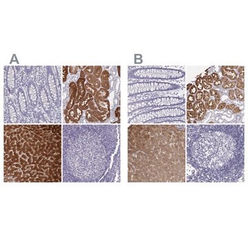 Anti-BHMT antibody produced in rabbit Prestige Antibodies&#174; Powered by Atlas Antibodies, affinity isolated antibody, buffered aqueous glycerol solution