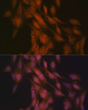 Anti-Gli3 Antibody, clone 8B1E2, Rabbit Monoclonal