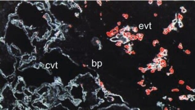 Monoclonal Anti-Cytokeratin Peptide 7 antibody produced in mouse clone LDS-68, ascites fluid