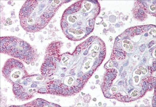 抗TRPC4抗体 ウサギ宿主抗体 affinity isolated antibody