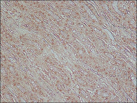 抗TDP-43 (C-末端) ウサギ宿主抗体 ~1.0&#160;mg/mL, affinity isolated antibody, buffered aqueous solution