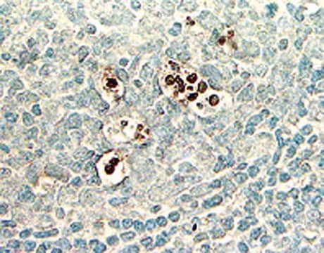 Kit de détection in situ de l'apoptose ApopTag Plus Peroxydase The ApopTag Plus Peroxidase In Situ Apoptosis Detection Kit detects apoptotic cells by labeling &amp; detecting DNA strand breaks by the indirect TUNEL method.