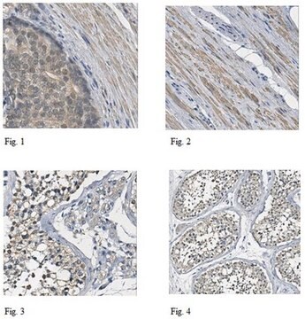 Anti-Death-associated protein 1 Antibody 1.0&#160;mg/mL, from rabbit