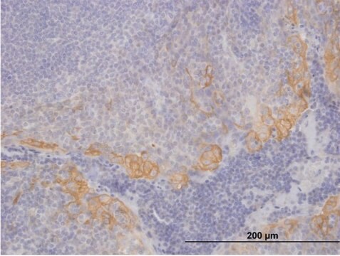 Anti-KRT19 antibody produced in mouse IgG fraction of antiserum, buffered aqueous solution