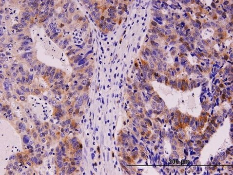 Monoclonal Anti-TYMS antibody produced in mouse clone 2B2, purified immunoglobulin, buffered aqueous solution