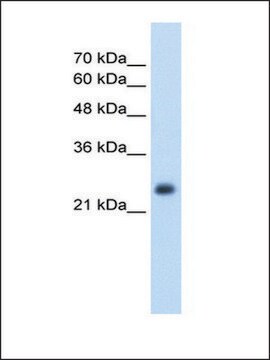 Anti-NNMT antibody produced in rabbit IgG fraction of antiserum