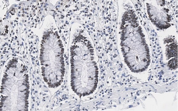 Anti-PRPF19 Antibody, clone 1K10 ZooMAb&#174; Rabbit Monoclonal recombinant, expressed in HEK 293 cells