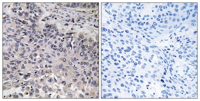 Anti-C1QC antibody produced in rabbit affinity isolated antibody