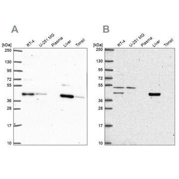 Anti-PHKG2 antibody produced in rabbit Prestige Antibodies&#174; Powered by Atlas Antibodies, affinity isolated antibody