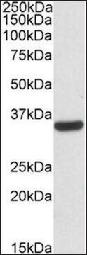 Anti-CNN2 antibody produced in goat affinity isolated antibody, buffered aqueous solution