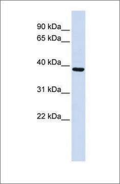 抗FBXO24抗体(ab1) ウサギ宿主抗体 affinity isolated antibody