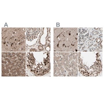 Anti-MLF2 antibody produced in rabbit Ab1, Prestige Antibodies&#174; Powered by Atlas Antibodies, affinity isolated antibody, buffered aqueous glycerol solution