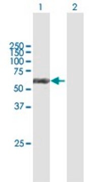 Anti-KRT6B antibody produced in mouse purified immunoglobulin, buffered aqueous solution