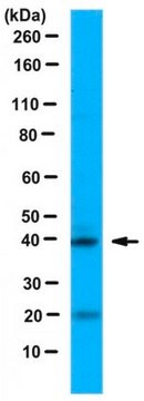 Anti-NeuroD1 Antibody serum, from rabbit