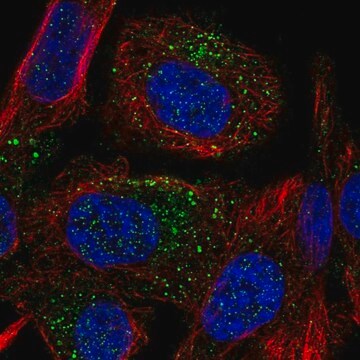 Anti-TMEM8B antibody produced in rabbit Prestige Antibodies&#174; Powered by Atlas Antibodies, affinity isolated antibody