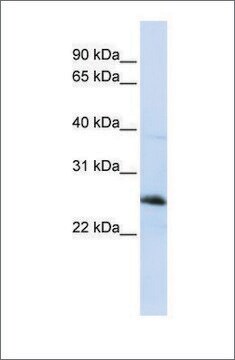 Anti-RTN1 (ab1) antibody produced in rabbit affinity isolated antibody