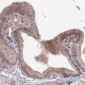 Anti-ABL2 antibody produced in rabbit Prestige Antibodies&#174; Powered by Atlas Antibodies, affinity isolated antibody