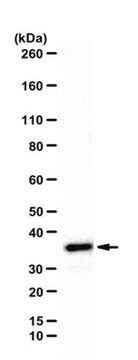 Anti-Sorting Nexin-11 Antibody from rabbit, purified by affinity chromatography