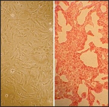 Rat Pulmonary Artery Smooth Muscle Cells: RPASMC, adult