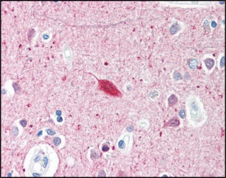 Anti-HARP antibody produced in rabbit affinity isolated antibody, buffered aqueous solution