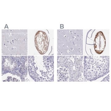 Anti-GJA8 antibody produced in rabbit Prestige Antibodies&#174; Powered by Atlas Antibodies, affinity isolated antibody