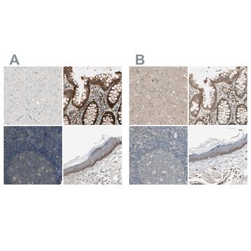 Anti-MST1R antibody produced in rabbit Ab2, Prestige Antibodies&#174; Powered by Atlas Antibodies, affinity isolated antibody, buffered aqueous glycerol solution