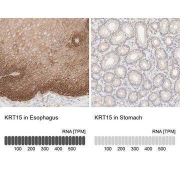 抗KRT15抗体 ウサギ宿主抗体 Prestige Antibodies&#174; Powered by Atlas Antibodies, affinity isolated antibody, buffered aqueous glycerol solution