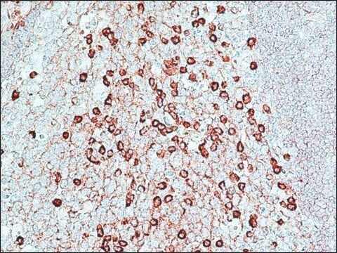 过氧化物酶抗过氧化物酶可溶性复合物 兔抗 affinity isolated antibody, buffered aqueous solution