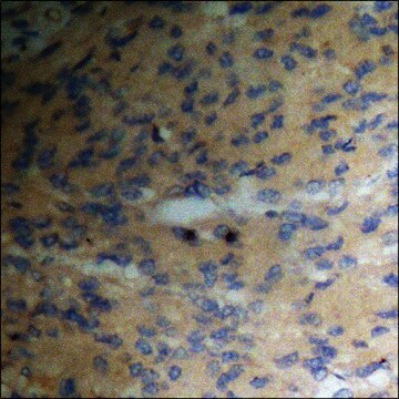 Anti-phospho-PKC &#948; (pThr505) antibody produced in rabbit affinity isolated antibody