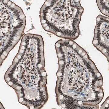 Anti-MKX antibody produced in rabbit Prestige Antibodies&#174; Powered by Atlas Antibodies, affinity isolated antibody, buffered aqueous glycerol solution