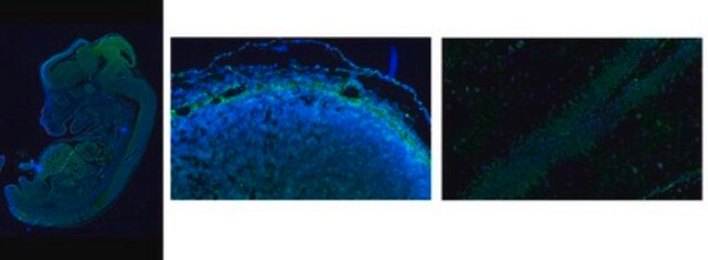 Anti-Neurocan Antibody, C-terminal from rabbit