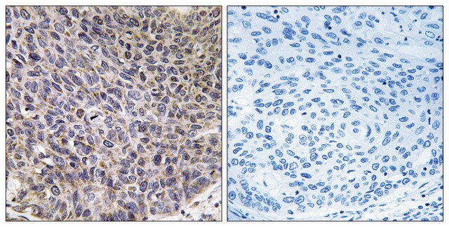 Anti-Cytochrome P450 4B1 antibody produced in rabbit affinity isolated antibody