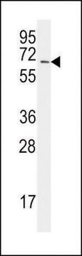 ANTI-SAE2 (UBA2) (C-TERM E616) antibody produced in rabbit IgG fraction of antiserum, buffered aqueous solution