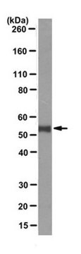 Anti-p53 Antibody, clone PAb421 clone PAb421, from mouse