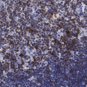 Anti-SH2D2A antibody produced in rabbit Prestige Antibodies&#174; Powered by Atlas Antibodies, affinity isolated antibody, buffered aqueous glycerol solution