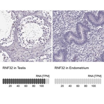 Anti-RNF32 antibody produced in rabbit Prestige Antibodies&#174; Powered by Atlas Antibodies, affinity isolated antibody