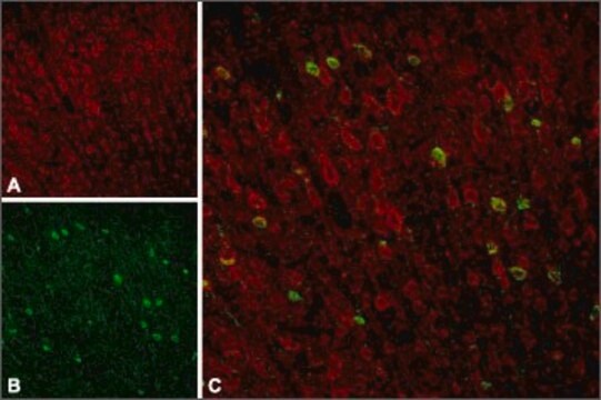 Anti-Sortilin 兔抗 lyophilized powder, affinity isolated antibody