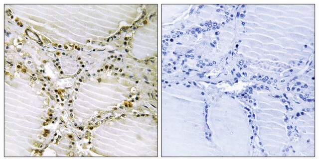 Anti-AMPD1 antibody produced in rabbit affinity isolated antibody