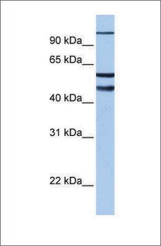 Anti-EZH1 antibody produced in rabbit affinity isolated antibody