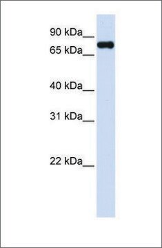 Anti-ZFYVE1 antibody produced in rabbit affinity isolated antibody