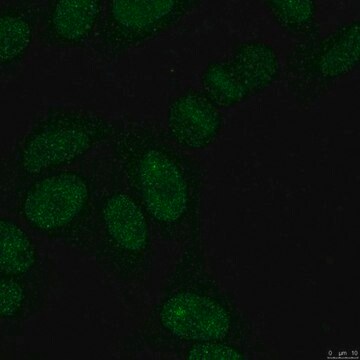 Anti-SUMO-2-/-3-Antikörper, Klon&nbsp;8A2 clone 8A2, from mouse