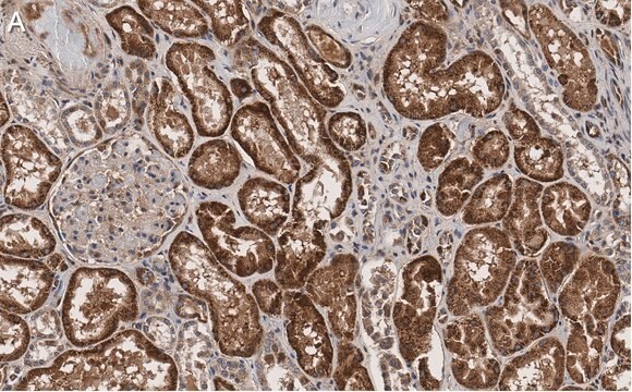 Anti-Angiotensinogen Antibody, clone 1B12 ZooMAb&#174; Rabbit Monoclonal recombinant, expressed in HEK 293 cells