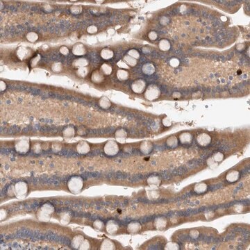 Anti-TARBP1 antibody produced in rabbit Prestige Antibodies&#174; Powered by Atlas Antibodies, affinity isolated antibody, buffered aqueous glycerol solution