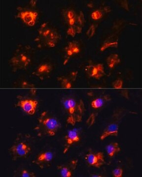 Anti-CD31 antibody produced in rabbit