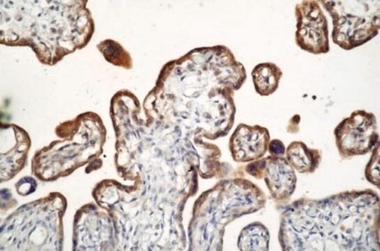 Przeciwciało anty-MMP-3, klon SL-1 IID4 clone SL-1 IID4, Chemicon&#174;, from mouse